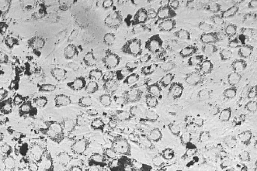 Působení nanočástic kobaltnato-zinečnatého feritu obaleného oxidem křemičitým na DNA, lipidy a proteiny mesenchymálních kmenových buněk z kostní dřeně potkanů